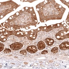 Immunohistochemical staining of human small intestine shows strong cytoplasmic positivity in glandular cells.