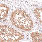 Immunohistochemical staining of human testis shows strong cytoplasmic positivity in cells in seminiferous ducts.