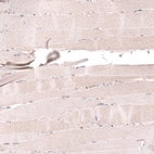 Immunohistochemical staining of human skeletal muscle shows no positivity in myocytes as expected.