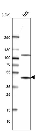 Western blot analysis in human cell line HEL.
