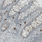 Immunohistochemical staining of human colon shows strong immunoreactivity in some lymphoid cells.