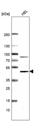 Anti-CMPK2 Antibody