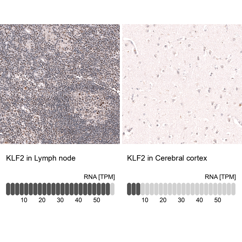 Anti-KLF2 Antibody