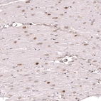 Immunohistochemical staining of human heart muscle shows moderate to strong nuclear positivity in cardiomyocytes.
