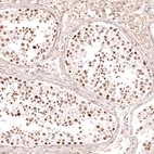 Immunohistochemical staining of human testis shows moderate to strong nuclear positivity in cells in seminiferous ducts.