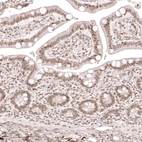 Immunohistochemical staining of human small intestine shows moderate nuclear positivity in glandular cells.