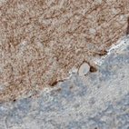 Immunohistochemical staining of human cerebellum shows moderate positivity in the molecular layer.