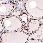 Anti-NKX2-1 Antibody