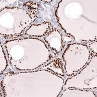 Immunohistochemical staining of human thyroid gland shows strong nuclear positivity in glandular cells.
