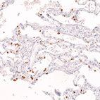 Immunohistochemical staining of human lung shows strong nuclear positivity in a subset of pneumocytes.