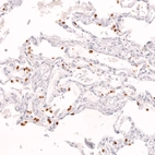 Immunohistochemical staining of human lung shows strong nuclear positivity in a subset of pneumocytes.