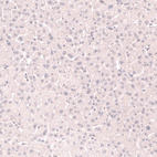 Immunohistochemical staining of human liver shows no positivity in hepatocytes as expected.