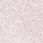 Anti-NKX2-1 Antibody