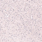 Immunohistochemical staining of human liver shows no positivity in hepatocytes as expected.