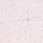 Immunohistochemical staining of human skeletal muscle shows no positivity in myocytes as expected.