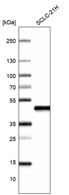 Western blot analysis in human cell line SCLC-21H.