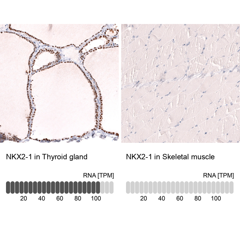 Anti-NKX2-1 Antibody