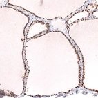 Immunohistochemical staining of human thyroid gland shows strong nuclear positivity in glandular cells.