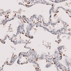 Immunohistochemical staining of human lung shows strong nuclear positivity in a subset of pneumocytes.