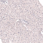 Immunohistochemical staining of human liver shows no positivity in hepatocytes as expected.