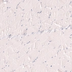 Immunohistochemical staining of human skeletal muscle shows no positivity in myocytes as expected.