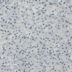 Immunohistochemical staining of human pancreas shows absence of immunoreactivity (negative control).