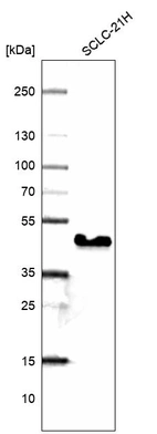 Western blot analysis in human cell line SCLC-21H.