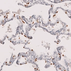 Immunohistochemical staining of human lung shows strong nuclear positivity in a subset of pneumocytes.