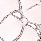 Immunohistochemical staining of human thyroid gland shows strong nuclear positivity in glandular cells.