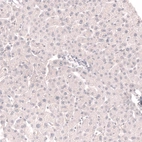 Immunohistochemical staining of human liver shows no positivity in hepatocytes as expected.