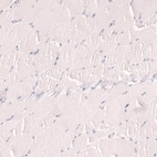 Immunohistochemical staining of human skeletal muscle shows no positivity in myocytes as expected.