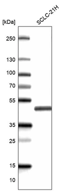 Western blot analysis in human cell line SCLC-21H.