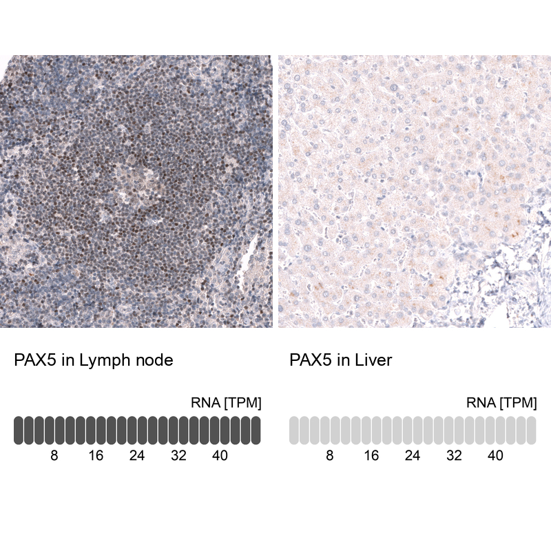Anti-PAX5 Antibody