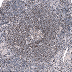 Immunohistochemical staining of human lymph node shows weak to moderate nuclear positivity in lymphoid cells.