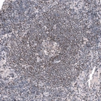 Immunohistochemical staining of human lymph node shows weak to moderate nuclear positivity in lymphoid cells.