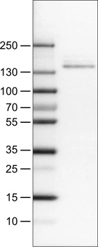 Lane 1: Marker [kDa]_br/_Lane 2: Human cell line RT-4