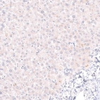 Immunohistochemical staining of human liver shows no nuclear positivity in hepatocytes as expected.