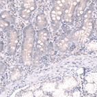 Immunohistochemical staining of human duodenum shows no positivity in glandular cells as expected.