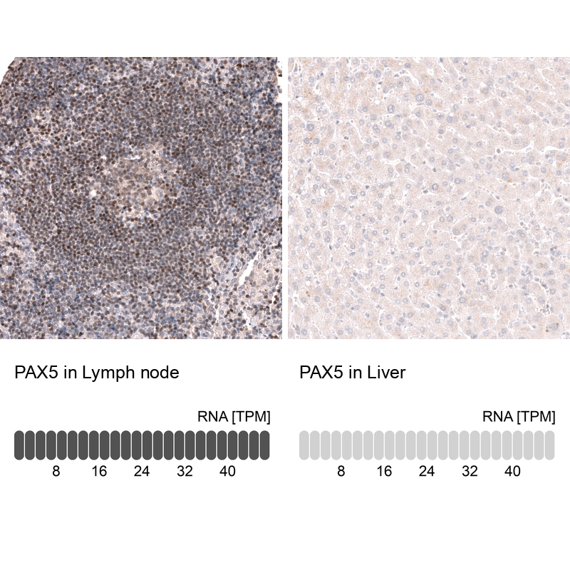 Anti-PAX5 Antibody