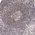 Immunohistochemical staining of human lymph node shows weak to moderate nuclear positivity in lymphoid cells.