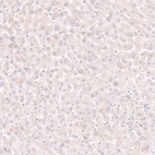 Immunohistochemical staining of human liver shows no nuclear positivity in hepatocytes as expected.