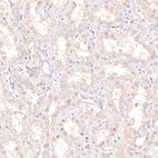 Immunohistochemical staining of human kidney shows no nuclear positivity in cells in tubules as expected.