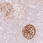 Immunohistochemical staining of human lymph node shows strong membranous positivity in germinal center cells.