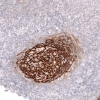 Immunohistochemical staining of human tonsil shows strong membranous positivity in germinal center cells.