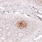 Immunohistochemical staining of human small intestine shows strong membranous positivity in a subset of lymphoid cells.