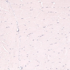 Immunohistochemical staining of human skeletal muscle shows no positivity in myocytes as expected.
