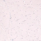 Immunohistochemical staining of human skeletal muscle shows no positivity in myocytes as expected.