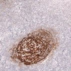 Immunohistochemical staining of human tonsil shows strong membranous positivity in germinal center.