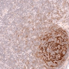 Immunohistochemical staining of human lymph node shows strong membranous positivity in germinal center.
