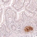 Immunohistochemical staining of human small intestine shows strong membranous positivity in lymph node.